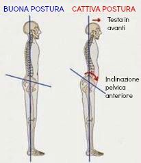 postura-inclinazione-pelvica-anteriore