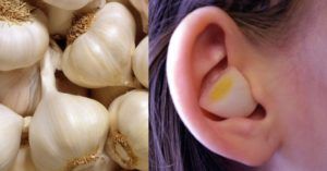 spicchio d'aglio: benefici e cosa succede inserendolo nell'orecchio